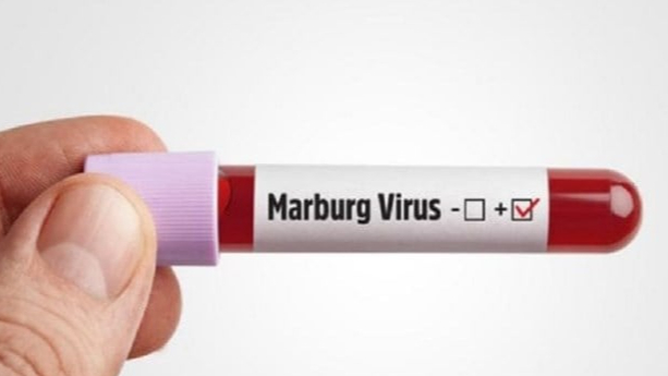 هل يدخل فيروس "ماربورغ" الى لبنان؟