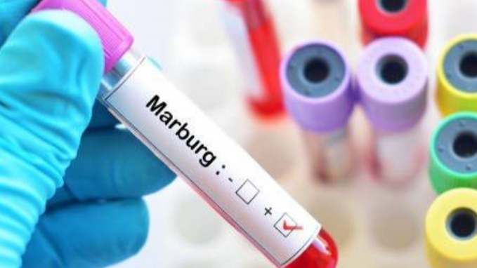 فيروس "ماربورغ".. ارتفاع حصيلة الضحايا إلى عشر وفيات